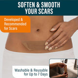 Silicone Scar Sheets - for C-Section, and Surgical Scars - Pack of 4
